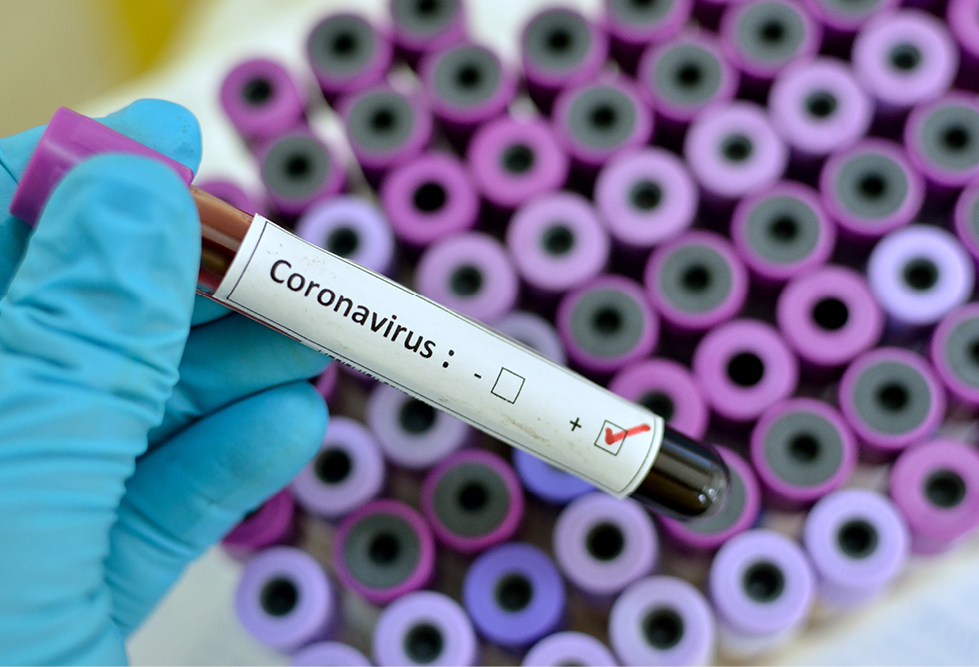 Coronavirus contagion concerns Coronavirus contagion concerns